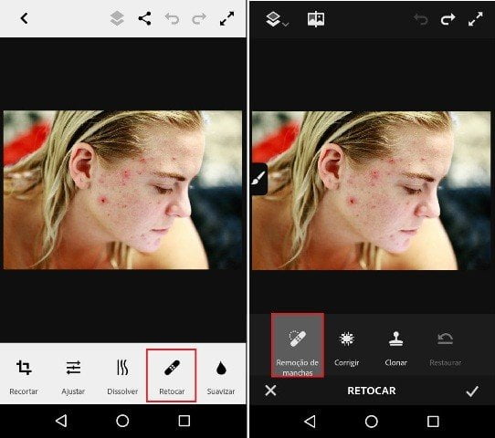 Como remover manchas do rosto em fotos?