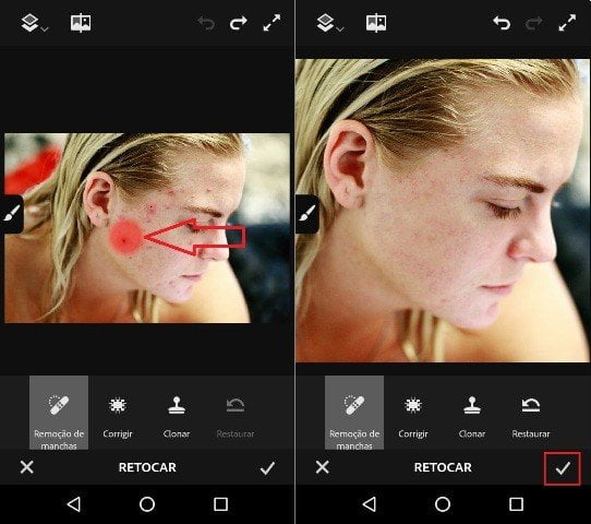 Como remover manchas do rosto em fotos?